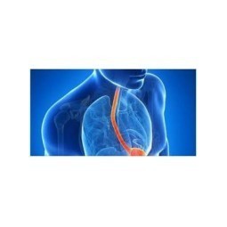 Reflusso Gastroesofageo