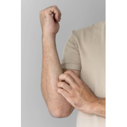 prurito-diffuso-rimedi-naturali-ayurvedici